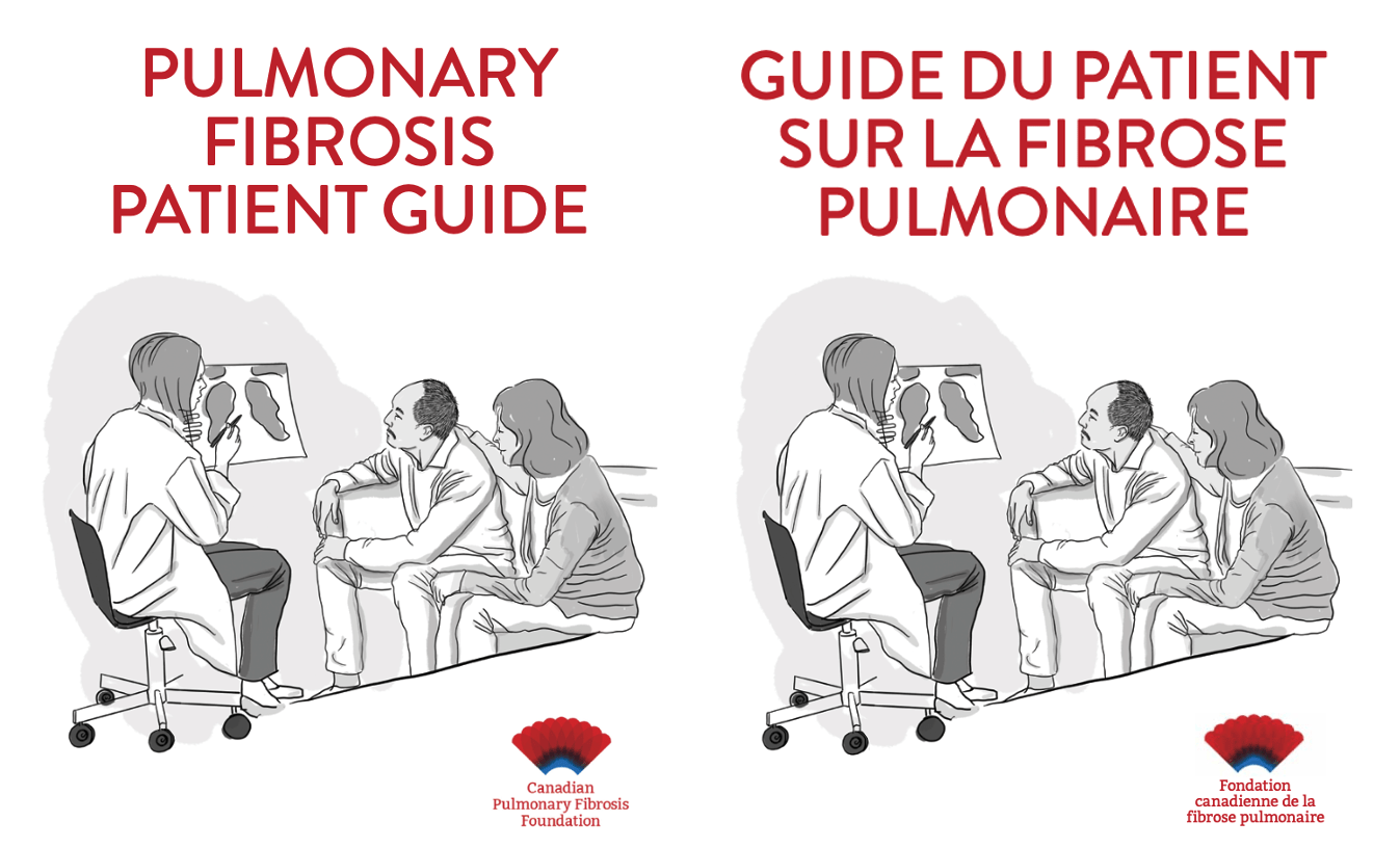 Pulmonary Fibrosis Patient Guide