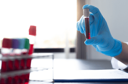 Creating Universal Blood-type Organs for Transplantation