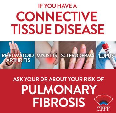 Connective Tissue Diseases and Pulmonary Fibrosis Graphic